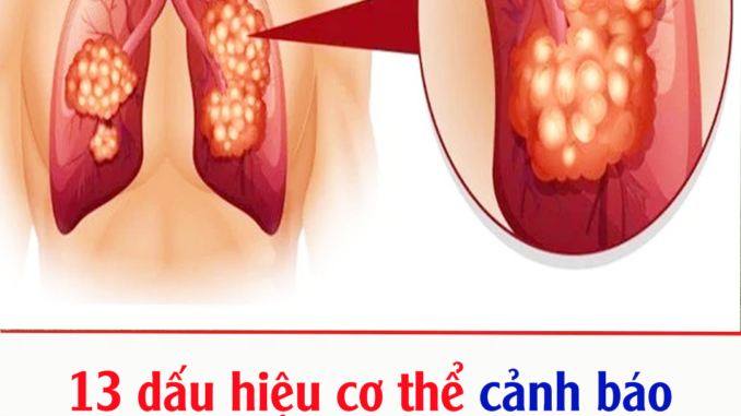 13 dấu hiệu cơ thể cảnh báo đang trong giai đoạn đầu của ung thư trước 2-5 năm