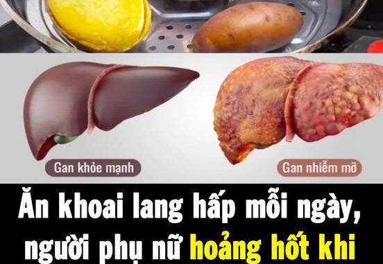 Ăn khoai lang hấp mỗi ngày, người phụ nữ hoảng hốt khi nhận kết quả khám gan: Sao lại như vậy được