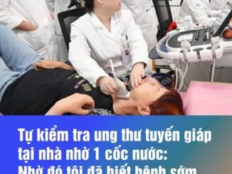 Tự kiểm tra u.n.g t.h.ư tuyến giáp tại nhà nhờ 1 cốc nước: Nhờ đó tôi đã biết bệnh sớm, dễ điều trị