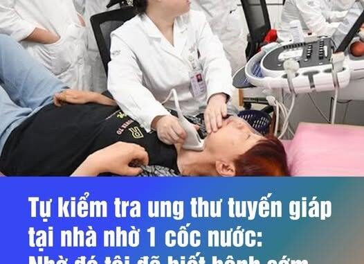 Tự kiểm tra u.n.g t.h.ư tuyến giáp tại nhà nhờ 1 cốc nước: Nhờ đó tôi đã biết bệnh sớm, dễ điều trị