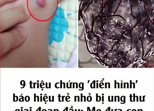 9 triệu chứng ‘điển hình’ báo hiệu trẻ nhỏ bị ung thư giai đoạn đầu: Mẹ đưa con đến viện ngay